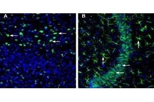 Expression of OCT3 (SLC22A3) in mouse cortex and hippocampus - Immunohistochemical staining of perfusion-fixed frozen mouse brain sections with Anti-SLC22A3 (extracellular) Antibody (ABIN7043416, ABIN7044223 and ABIN7044224), (1:200), followed by goat anti-rabbit-AlexaFluor-488.