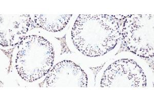 Immunohistochemistry of paraffin-embedded Mouse testis using Bcl9 Polyclonal Antibody at dilution of 1:100 (20x lens). (BCL9 anticorps)