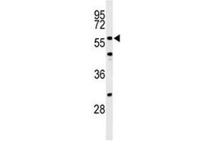 Western blot analysis of CDC25C antibody and NIH3T3 lysate.
