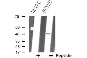 Western blot analysis of extracts from HUVEC cells, using ZNF24 antibody. (ZNF24 anticorps  (Internal Region))