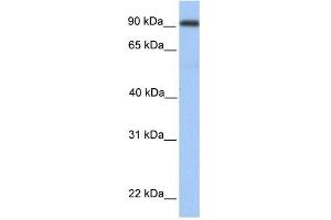MMEL1 antibody used at 1 ug/ml to detect target protein. (MMEL1 anticorps  (Middle Region))