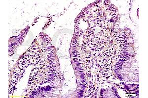 Formalin-fixed and paraffin embedded rat intestine tissue labeled with Anti-GM-CSF Polyclonal Antibody (ABIN730723), Unconjugated at 1:200, followed by conjugation to the secondary antibody and DAB staining (GM-CSF anticorps  (AA 71-141))