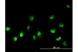 Image no. 2 for anti-NIMA (Never In Mitosis Gene A)-Related Kinase 11 (NEK11) (AA 1-483) antibody (ABIN599307) (NEK11 anticorps  (AA 1-483))