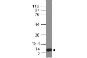 Image no. 1 for anti-Activin A Receptor Type II-Like 1 (ACVRL1) (AA 310-503) antibody (ABIN5027019)