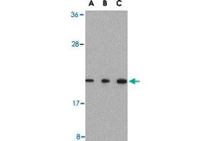 Western blot analysis of TMED10 in Raji cell lysate with TMED10 polyclonal antibody  at (A) 0. (TMED10 anticorps  (C-Term))