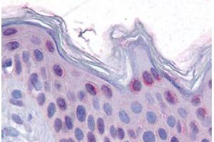 Human Skin: Formalin-Fixed, Paraffin-Embedded (FFPE)