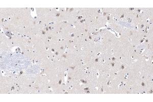 Detection of LCAT in Human Cerebrum Tissue using Monoclonal Antibody to Lecithin Cholesterol Acyltransferase (LCAT)