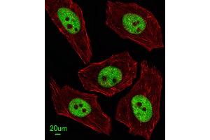 Immunofluorescent analysis of  cells, using FEN1 Antibody (Center) (ABIN389376 and ABIN2839472).