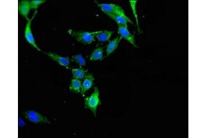 anti-Cas-Br-M (Murine) Ecotropic Retroviral Transforming Sequence (CBL) (AA 548-847) antibody