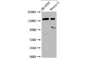 Western Blot Positive WB detected in: SH-SY5Y whole cell lysate, Ntera-2 whole cell lysate All lanes: ROBO2 antibody at 1:2000 Secondary Goat polyclonal to rabbit IgG at 1/50000 dilution Predicted band size: 131, 152, 154 kDa Observed band size: 152 kDa (ROBO2 anticorps  (AA 450-660))