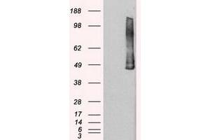 Image no. 2 for anti-Polo-Like Kinase 1 (PLK1) antibody (ABIN1500282)
