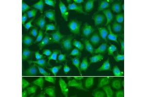 Immunofluorescence analysis of A549 cells using XRCC2 Polyclonal Antibody (XRCC2 anticorps)