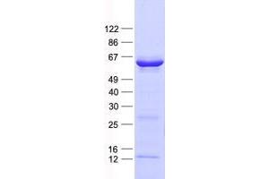 Validation with Western Blot
