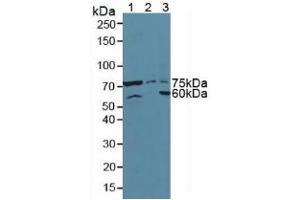 Western blot analysis of (1) Mouse Pancreas Tissue, (2) Human HeLa cells and (3) Human 293T Cells. (ATF6 anticorps  (AA 423-646))