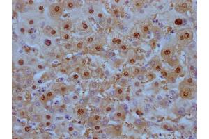 IHC image of ABIN7180448 diluted at 1:100 and staining in paraffin-embedded human liver tissue performed on a Leica BondTM system. (Liver Arginase anticorps)
