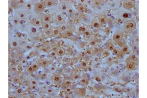 IHC image of ABIN7180448 diluted at 1:100 and staining in paraffin-embedded human liver tissue performed on a Leica BondTM system.