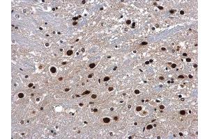 IHC-P Image p54/nrb antibody detects p54/nrb protein at nucleus in mouse brain by immunohistochemical analysis. (NONO anticorps  (N-Term))