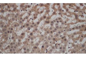 Immunohistochemistry of paraffin-embedded Rat liver using CALCRL Polyclonal Antibody at dilution of 1:50 (CALCRL anticorps)