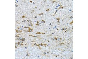 Immunohistochemistry of paraffin-embedded mouse spinal cord using PDP1 antibody (ABIN6132860, ABIN6145404, ABIN6145405 and ABIN6221944) at dilution of 1:100 (40x lens).