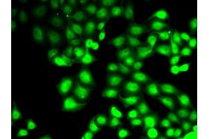 Immunofluorescence analysis of HeLa cells using GCK antibody. (GCK anticorps)
