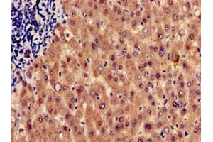 Immunohistochemistry of paraffin-embedded human liver tissue using ABIN7155233 at dilution of 1:100 (HRH1 anticorps  (AA 211-416))