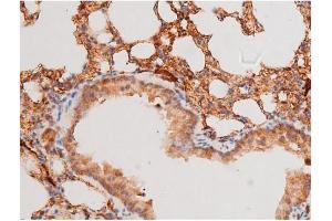 ABIN6267579 at 1/200 staining Mouse lung tissue sections by IHC-P.