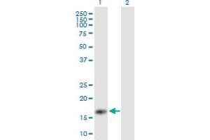 Western Blot analysis of PYCARD expression in transfected 293T cell line by PYCARD MaxPab polyclonal antibody.
