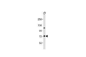 Anti-TAB2 Antibody (C-term)at 1:2000 dilution + C6 whole cell lysates Lysates/proteins at 20 μg per lane. (TAB2 anticorps  (C-Term))