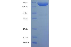 SDS-PAGE (SDS) image for Keratin 77 (KRT77) (AA 1-578), (full length) protein (His-SUMO Tag) (ABIN5711465)