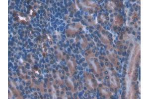 DAB staining on IHC-P; Samples: Mouse Kidney Tissue