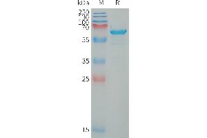 Human W Protein, hFc Tag on SDS-PAGE under reducing condition.