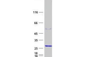 Validation with Western Blot
