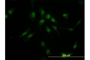 Immunofluorescence of monoclonal antibody to IRX5 on HeLa cell. (IRX5 anticorps  (AA 204-264))