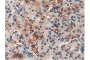 Figure. (DLD anticorps  (AA 238-466))