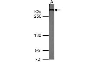 WB Image Sample (30 ug of whole cell lysate) A:NIH-3T3 5% SDS PAGE antibody diluted at 1:1000 (NOTCH2 anticorps  (C-Term))