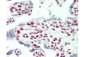 Anti-TCERG1 / CA150 antibody IHC staining of human placenta. (TCERG1 anticorps  (AA 1-50))