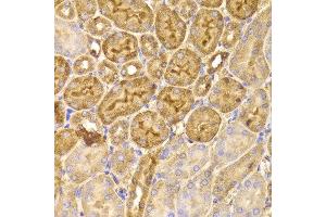 Immunohistochemistry of paraffin-embedded Mouse kidney using FDPS antibody at dilution of 1:100 (x400 lens). (FDPS anticorps)