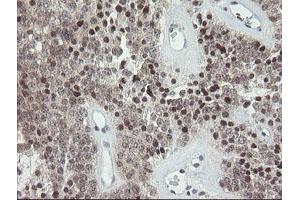 Image no. 7 for anti-Golgin, RAB6-Interacting (GORAB) (AA 35-394) antibody (ABIN1491441)