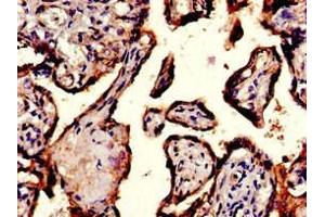 Immunohistochemistry of paraffin-embedded human placenta tissue using ABIN7156442 at dilution of 1:100 (ITGA5 anticorps  (AA 220-472))