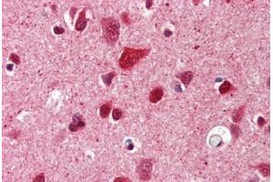 Brain, cortex, Human: Formalin-Fixed, Paraffin-Embedded (FFPE) (Ubiquitin anticorps)