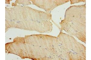 Immunohistochemistry of paraffin-embedded human skeletal muscle tissue using ABIN7159778 at dilution of 1:100