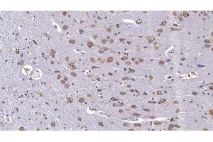 Detection of RELN in Human Cerebrum Tissue using Monoclonal Antibody to Reelin (RELN) (Reelin anticorps  (AA 2978-3373))