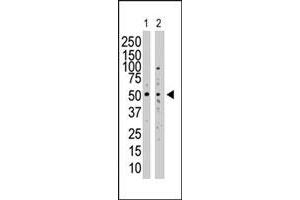 Western blot analysis of SUV39H1 polyclonal antibody  in SAOS-2 cell lysate (Lane 1) and NIH/3T3 cell lysate (Lane 2) .