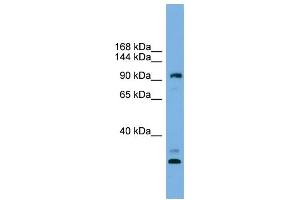 WB Suggested Anti-CCDC110 Antibody Titration: 0.