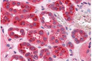 Human Kidney: Formalin-Fixed, Paraffin-Embedded (FFPE)