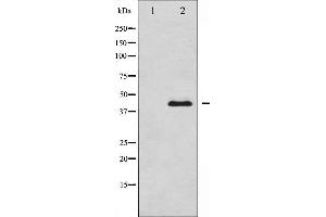 Western blot analysis of MEK1/2 expression in UV treated Jurkat whole cell lysates,The lane on the left is treated with the antigen-specific peptide. (MEK1 anticorps  (Internal Region))