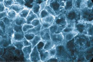 Immunofluorescence staining of A431 cells (Human epithelial carcinoma, ATCC CRL-1555).