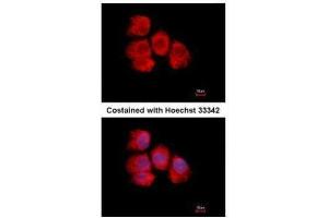 ICC/IF Image Immunofluorescence analysis of methanol-fixed A431, using IMPDH2, antibody at 1:500 dilution.