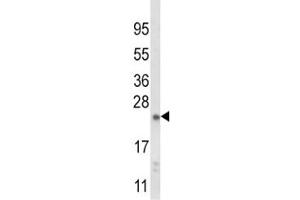 Western blot analysis of NQO2 antibody and mouse liver tissue lysate