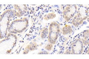 Detection of PRDX6 in Human Stomach Tissue using Polyclonal Antibody to Peroxiredoxin 6 (PRDX6)